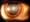 Applying the 'cataract test' to skyrocketing health-care costs
